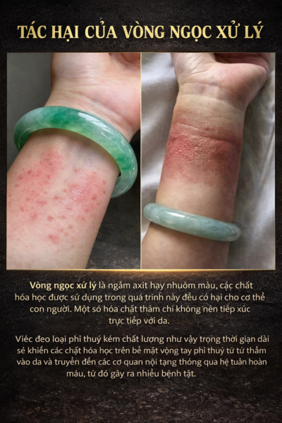 Ngọc Phỉ Thuý Type A, B, C Là Gì? Tại Sao Không Nên Đeo Ngọc Đã Qua Xử Lý? Ngọc Phỉ Thuý Type A, B, C Là Gì? Tại Sao Không Nên Đeo Ngọc Đã Qua Xử Lý?